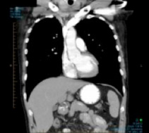 Computed Tomography (CT)