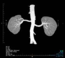 Computed Tomography (CT)