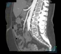 Computed Tomography (CT)