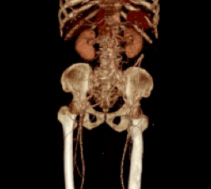 Computed Tomography (CT)